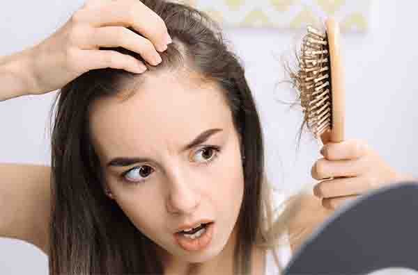 Hairloss-photo-2-530x350-1
