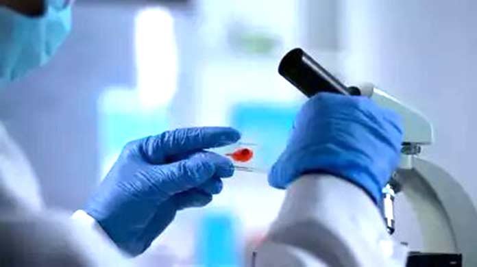 Can-HIV-self-test